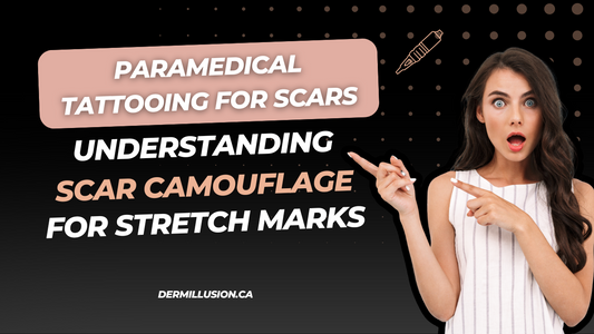 Paramedical Tattooing for Scars : Understanding Scar Camouflage for Stretch Marks 2025 in Edmonton with Dermillusion
